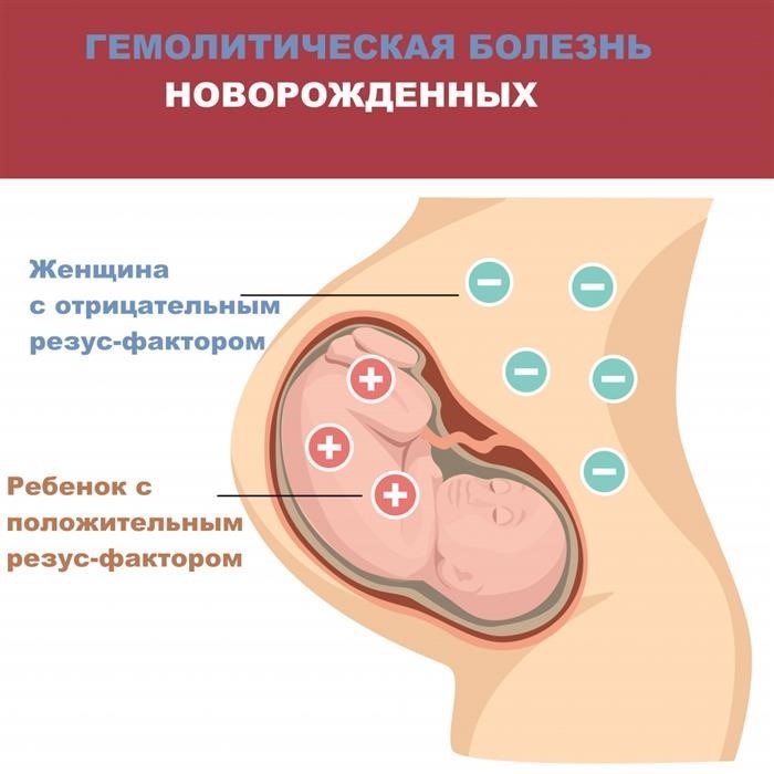 Резус при беременности.jpg